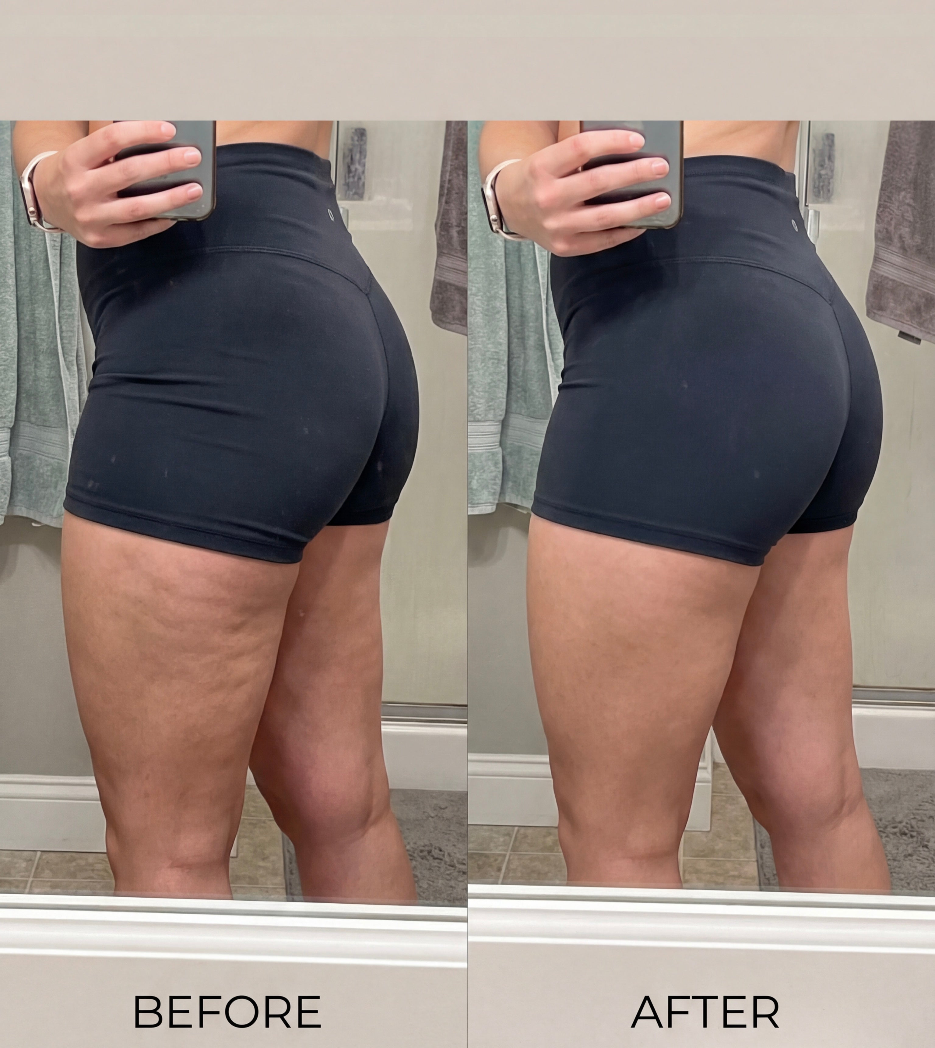 5 in 1 Body Sculpting Massager